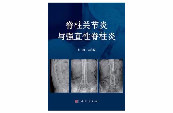 脊柱关节炎与强直性脊柱炎 脊柱关节炎与强直性脊柱炎