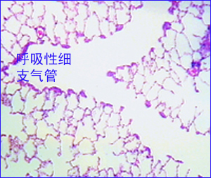 急性肺栓塞 急性肺栓塞