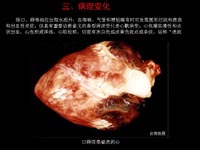 胸膜肺炎 胸膜肺炎