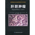 肝胆肿瘤 肝胆肿瘤