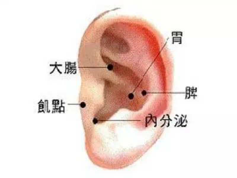 耳穴压豆法 耳穴压豆法