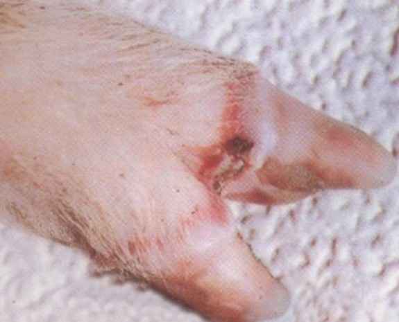 猪水疱性口炎 猪水疱性口炎