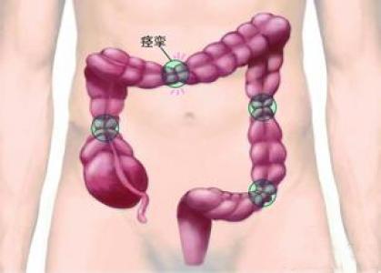肠道痉挛 肠道痉挛