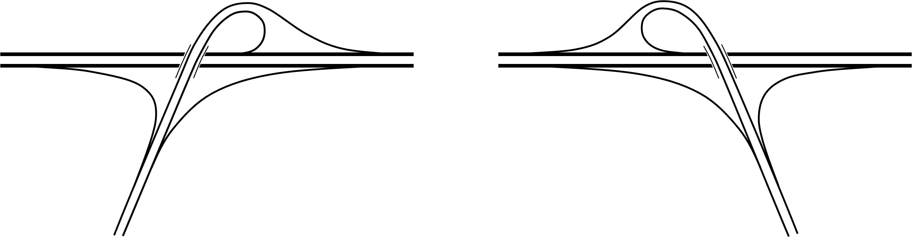 A型(左),B型(右) A型(左),B型(右)