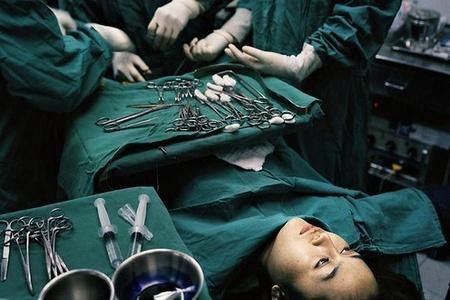 变性手术过程 变性手术过程