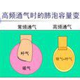 高频通气 高频通气
