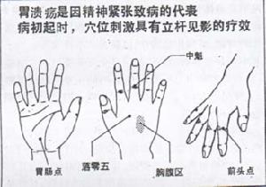 胃胀 胃胀