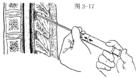 《各种麻醉方法的操作》 《各种麻醉方法的操作》