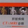 肝脏疾病CT与MRI诊断 肝脏疾病CT与MRI诊断