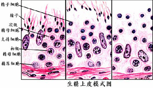 无精子症 无精子症