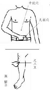 胃胀 胃胀