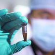 H7N7禽流感 H7N7禽流感