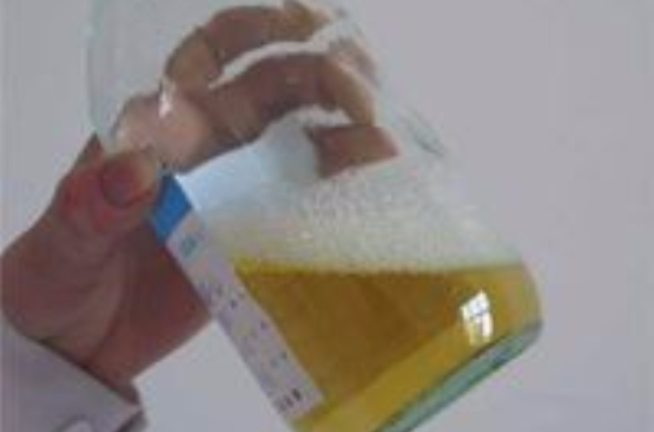 尿蛋白弱阳性 尿蛋白弱阳性