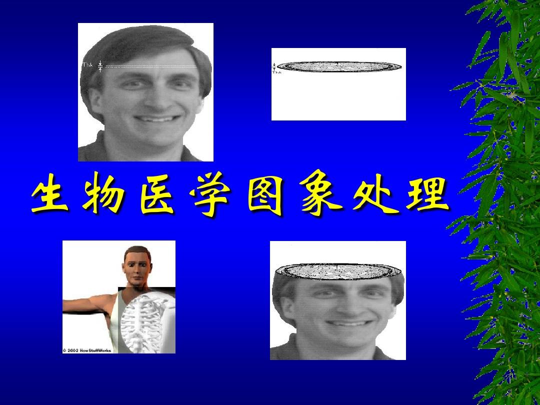 医学图像处理(聂生东、邱建峰、郑建立主编书籍) 医学图像处理(聂生东、邱建峰、郑建立主编书籍)
