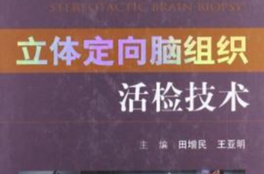 立体定向脑组织活检技术 立体定向脑组织活检技术