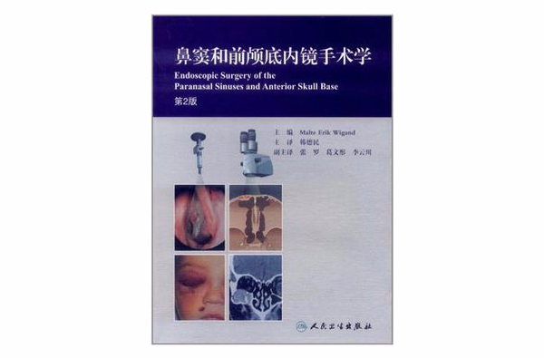 鼻窦和前颅底内镜手术学 鼻窦和前颅底内镜手术学