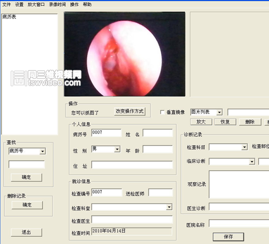 内窥镜检查 内窥镜检查