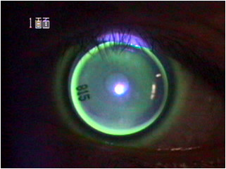 露晰得RGP 露晰得RGP