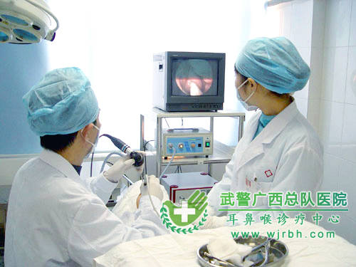 鼻内窥镜 鼻内窥镜