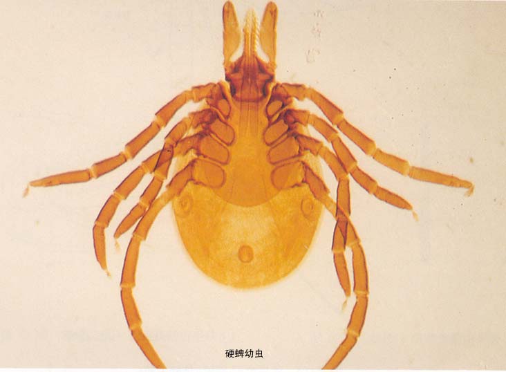 人粒细胞无形体病 人粒细胞无形体病