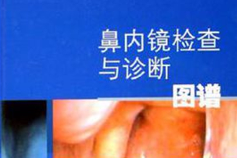 鼻内镜检查与诊断图谱 鼻内镜检查与诊断图谱
