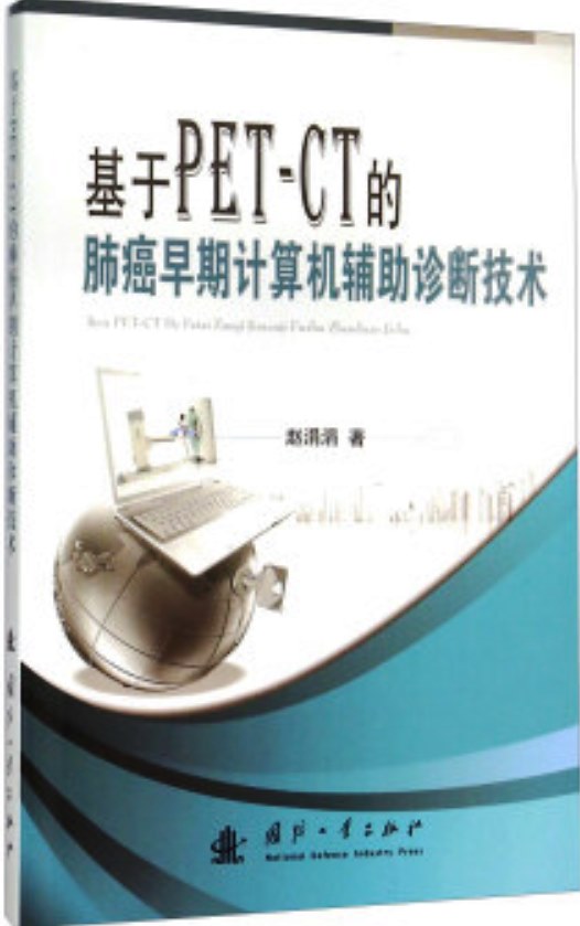 基于PET-CT的肺癌早期计算机辅助诊断技术 基于PET-CT的肺癌早期计算机辅助诊断技术