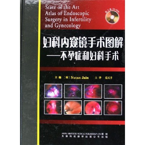 妇科内窥镜手术图解:不孕症和妇科手术 妇科内窥镜手术图解:不孕症和妇科手术