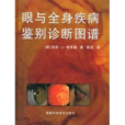 眼与全身疾病鉴别诊断图谱 眼与全身疾病鉴别诊断图谱