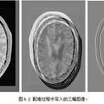 医学图像配準 医学图像配準