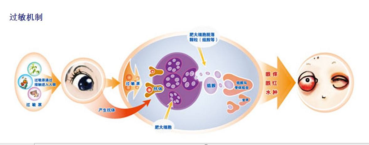 眼部过敏 眼部过敏