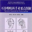 耳鼻咽喉科手术要点图解 耳鼻咽喉科手术要点图解