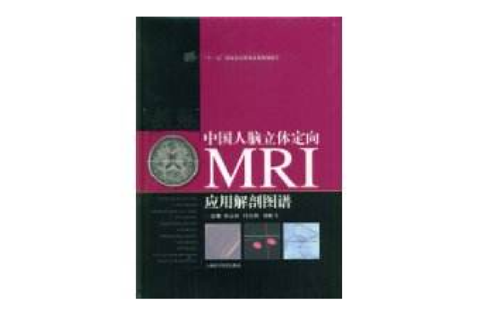 中国人脑立体定向MRI套用解剖图谱 中国人脑立体定向MRI套用解剖图谱