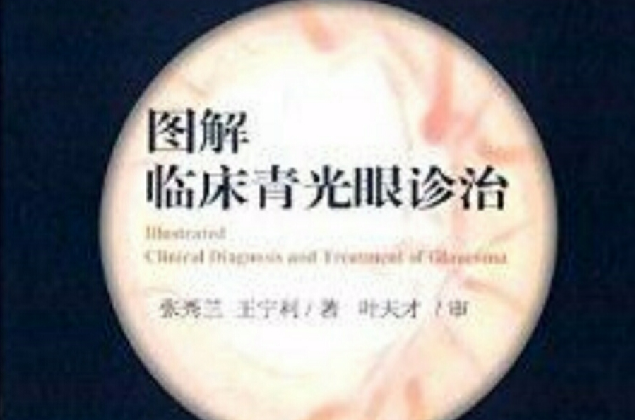 图解临床青光眼诊治 图解临床青光眼诊治