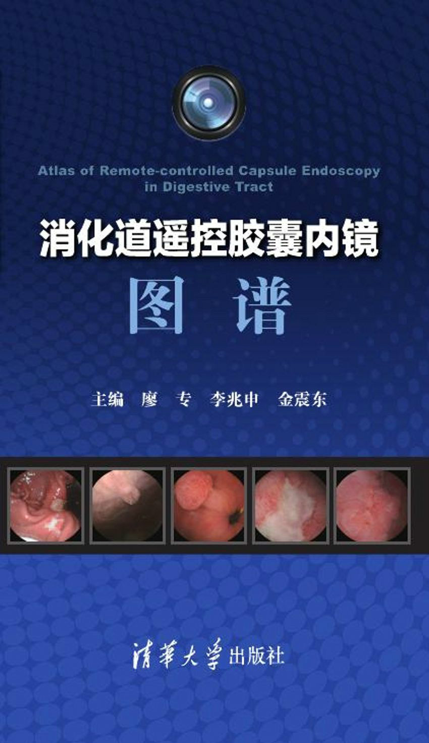 消化道遥控胶囊内镜图谱 消化道遥控胶囊内镜图谱