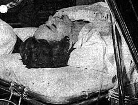 1967年,珍妮弗·琼斯因吃安眠药被救护人员抬走 1967年,珍妮弗·琼斯因吃安眠药被救护人员抬走