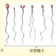 精子精液异常 精子精液异常