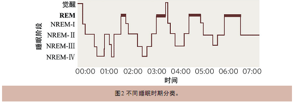 睡眠分期 睡眠分期