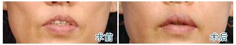面部整容 面部整容