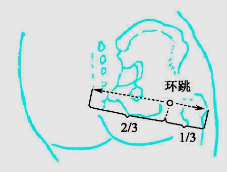 传统定位法 传统定位法
