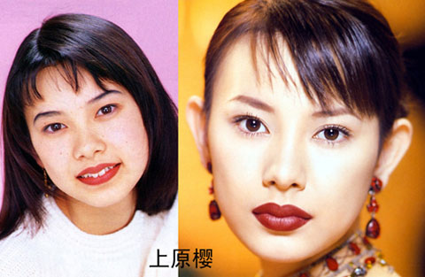 整容 前后对比 整容 前后对比