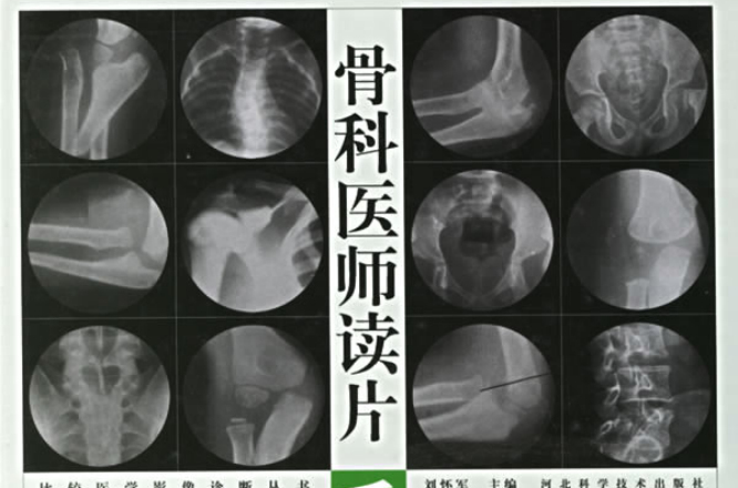 骨科医师读片手册 骨科医师读片手册