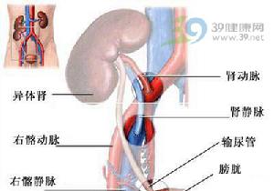 肾活检 肾活检