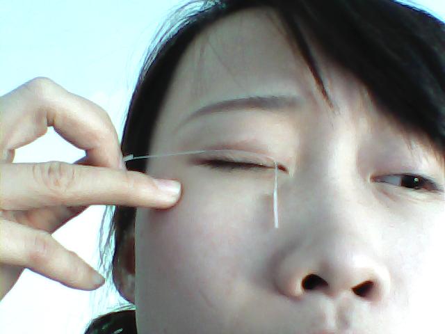 压双眼皮 压双眼皮