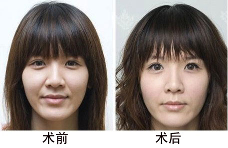 张冰洁(整形医生) 张冰洁(整形医生)