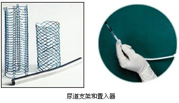 尿道支架 尿道支架