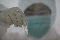 甲型H1N1流感疫苗毒株 甲型H1N1流感疫苗毒株