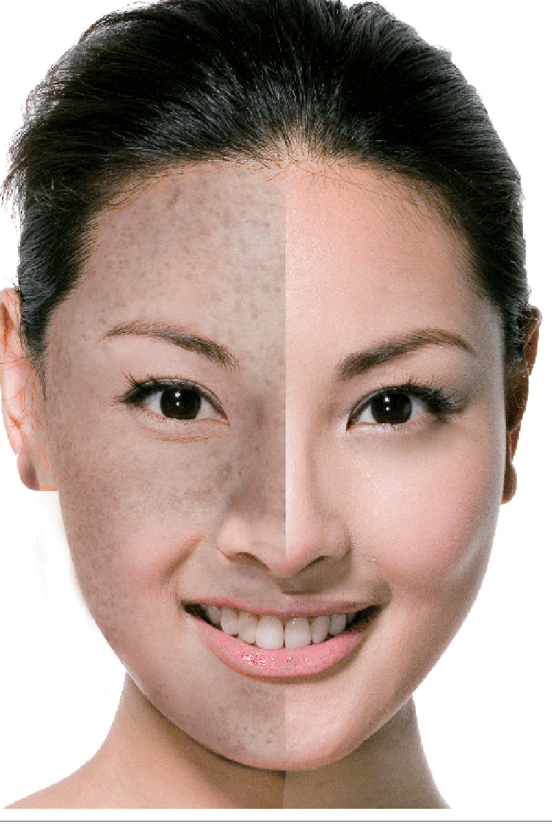 肌肤对比图 肌肤对比图