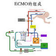 ECMO--体外膜肺氧合 ECMO--体外膜肺氧合