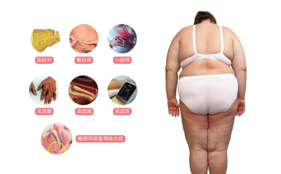 中心性肥胖 中心性肥胖
