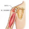 腘肌肌腱炎 腘肌肌腱炎